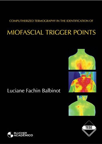 Computherized Termography in the Identificacion of MIOFASCIAL TRIGGER POINTS